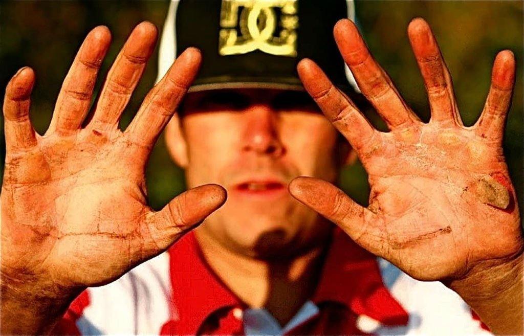 How to Prevent Blisters When Riding Motocross (7 Steps) - Risk Racing